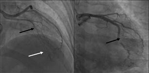 Descripción: C:\scielo\serial\rac\v91n3\scielo_markup\img\a11\img628.jpg