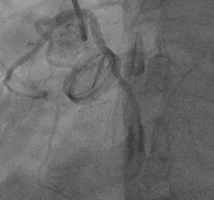 Descripción: C:\scielo\serial\rac\v91n3\scielo_markup\img\a11\img630.jpg