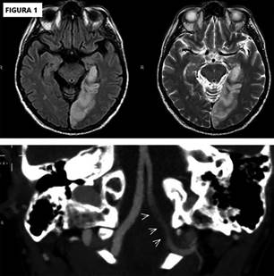 Descripción: C:\scielo\serial\rac\v91n3\scielo_markup\img\a11\img13.jpg