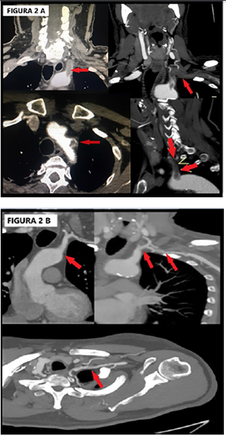 Descripción: C:\scielo\serial\rac\v91n3\scielo_markup\img\carta esp.png