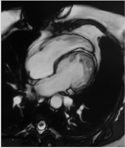 Figura 3
