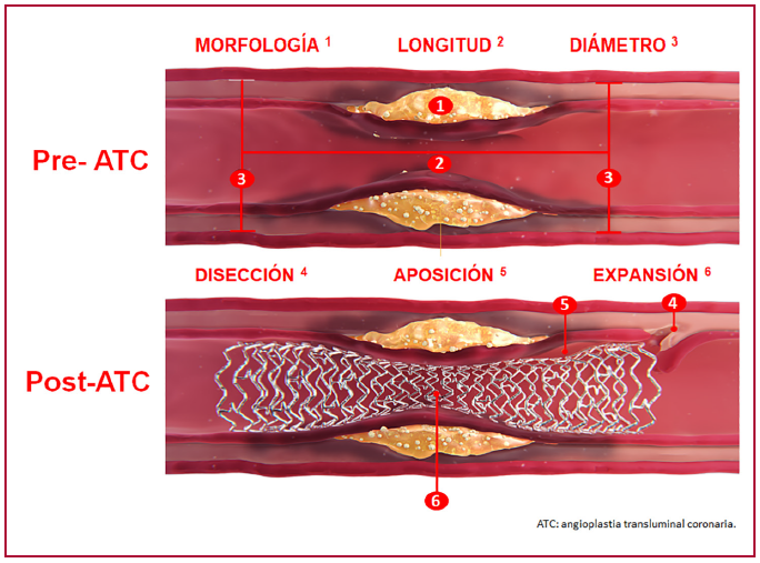 Imagen 2