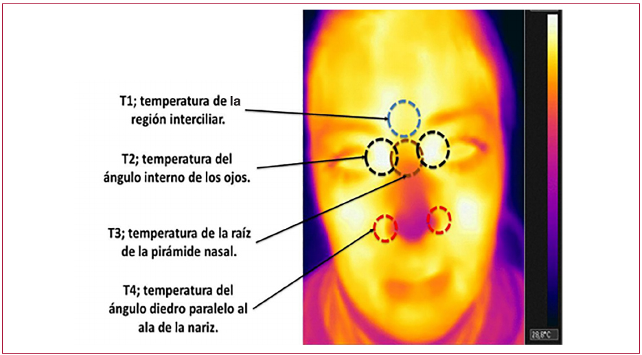 Figura 1